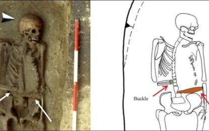 Sorpresa con los restos de un hombre medieval: reemplazó su mano amputada con un cuchillo